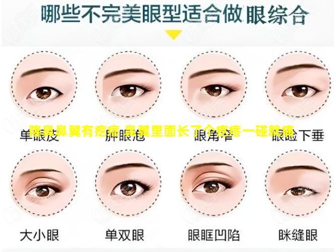 隆鼻鼻翼有疙瘩 鼻翼里面长了个疙瘩一碰就痛